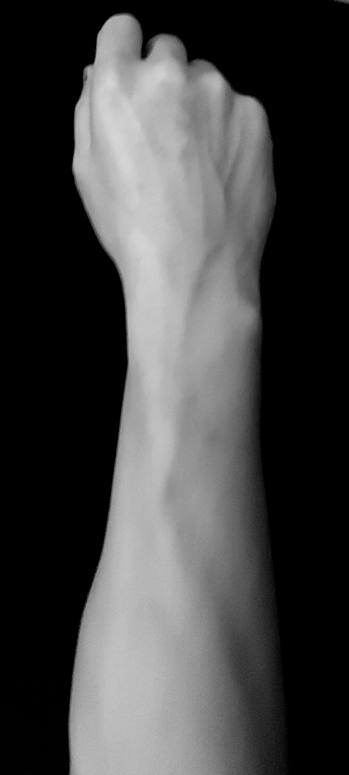 Who Wants My Arm Overige