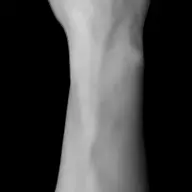 Who Wants My Arm Fetish